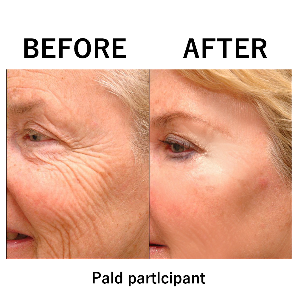 š„ćOfficial Brand StorećInstant FIRMx Temporary Face Tightenerā 87% OFF!
