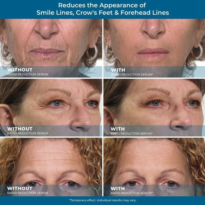 Sale Happening Now:70%OFF🔥Rapid Reduction Eye Serum – Instant Tightening & Anti-Aging for Eyes & Face ✨