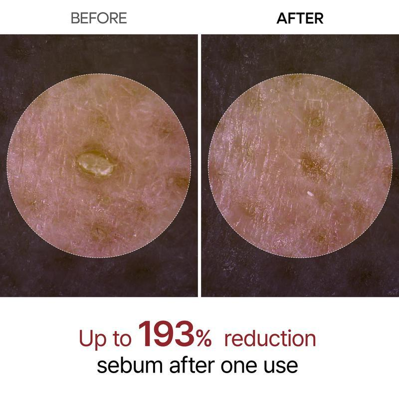 Sale Happening Now:70%OFF🔥Gentle Exfoliator Glow Rice Ampoule-Suitable for All Skin Types