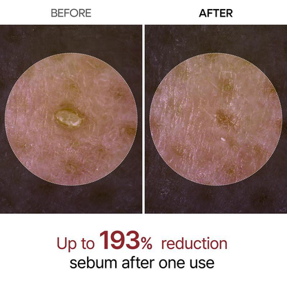 Sale Happening Now:70%OFF🔥Gentle Exfoliator Glow Rice Ampoule-Suitable for All Skin Types