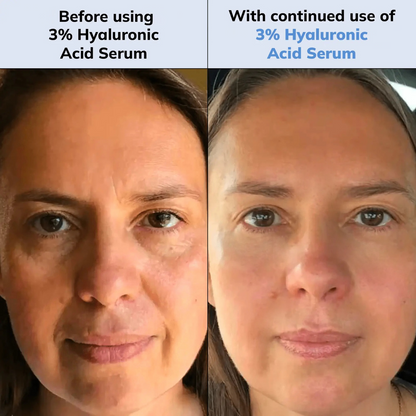 3% Ultra Hydrating Hyaluronic Acid Serum
