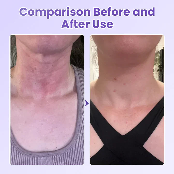 NeckYouth Peptide Anti-Wrinkle Patch