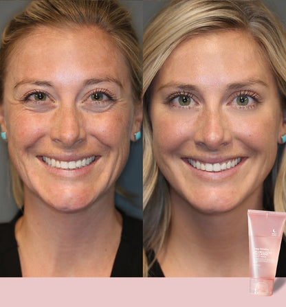 🔥 Hydrolyzed Collagen Night Mask for Glowing Skin-Erase Wrirkles✨𝐋𝐚𝐬𝐭 𝐃𝐚𝐲 𝐃𝐢𝐬𝐜𝐨𝐮𝐧𝐭: 87% 𝐎𝐅𝐅