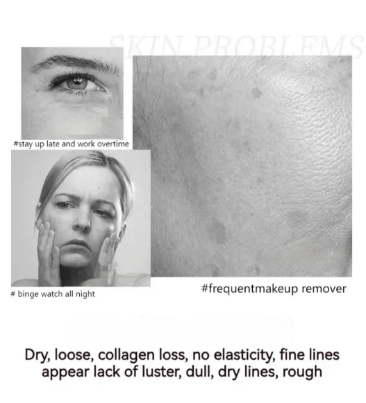 🔥 Buy 1 Get 1 Free🔥POLYPEPTIDE FIRMING FULL FACE CREAM-CHANGE FOR BEAUTIFUL SKIN WITHIN 2 WEEKS