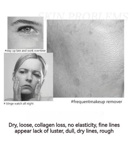 🔥 Buy 1 Get 1 Free🔥POLYPEPTIDE FIRMING FULL FACE CREAM-CHANGE FOR BEAUTIFUL SKIN WITHIN 2 WEEKS